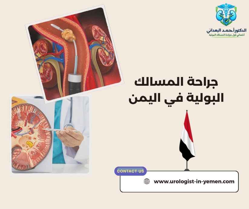 جراحة المسالك البولية في اليمن جراحة المسالك البولية في اليمن