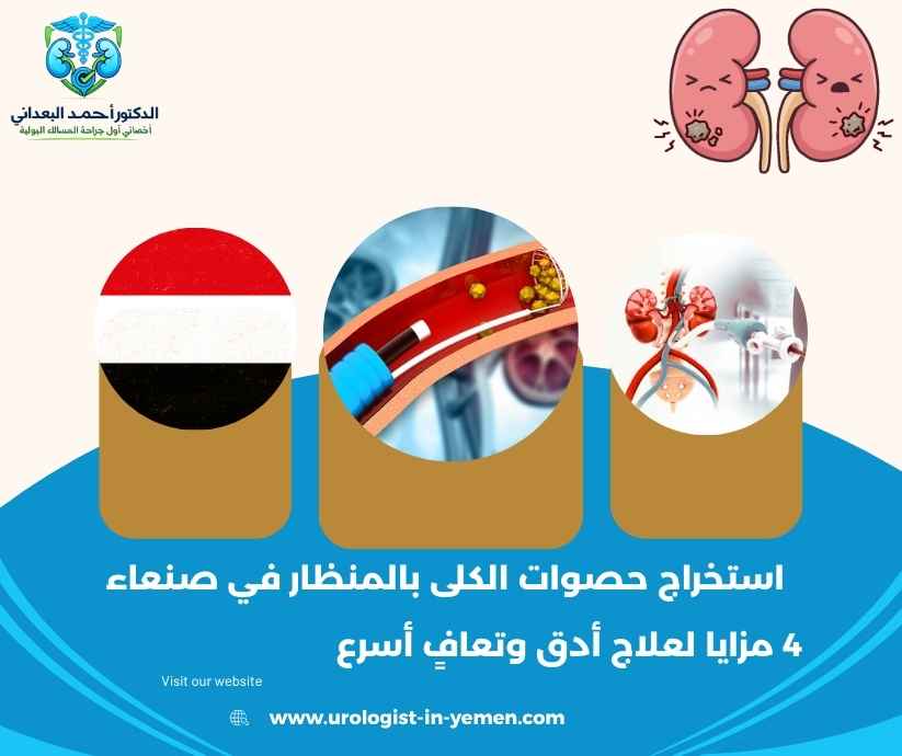 استخراج حصوات الكلى بالمنظار في صنعاء