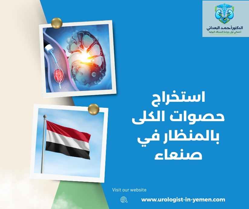 استخراج حصوات الكلى بالمنظار في صنعاء استخراج حصوات الكلى بالمنظار في صنعاء