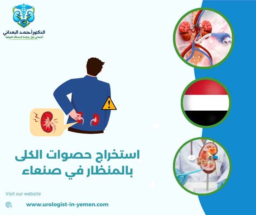 استخراج حصوات الكلى بالمنظار في صنعاء استخراج حصوات الكلى بالمنظار في صنعاء
