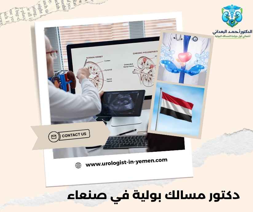دكتور مسالك بولية في صنعاء