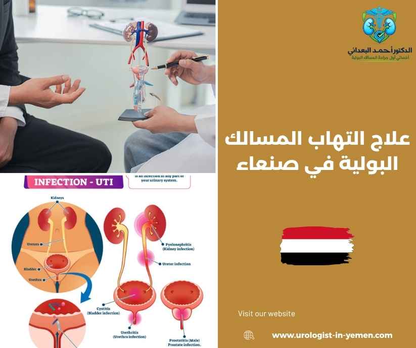 علاج التهاب المسالك البولية في صنعاء علاج التهاب المسالك البولية في صنعاء