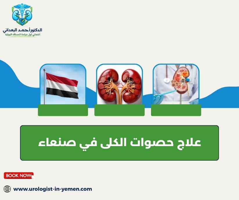 علاج حصوات الكلى في صنعاء