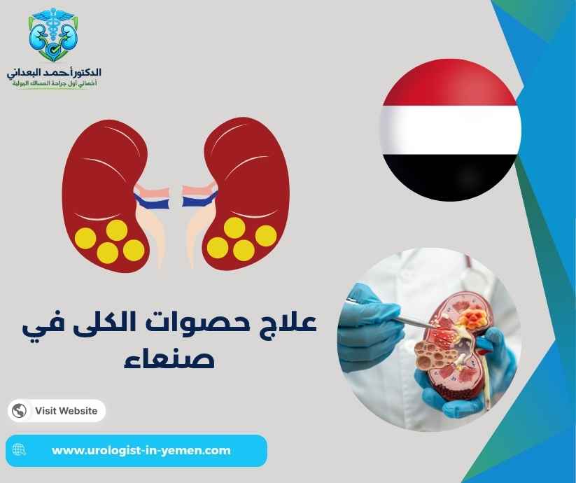 علاج حصوات الكلى في صنعاء
