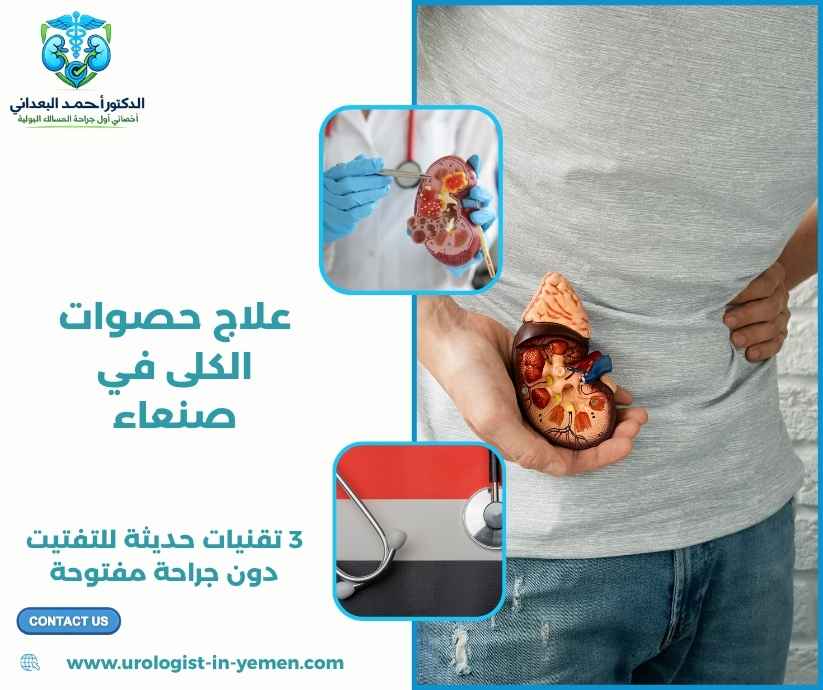 علاج حصوات الكلى في صنعاء