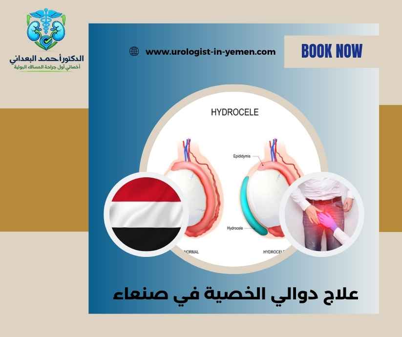 علاج دوالي الخصية في صنعاء علاج دوالي الخصية في صنعاء