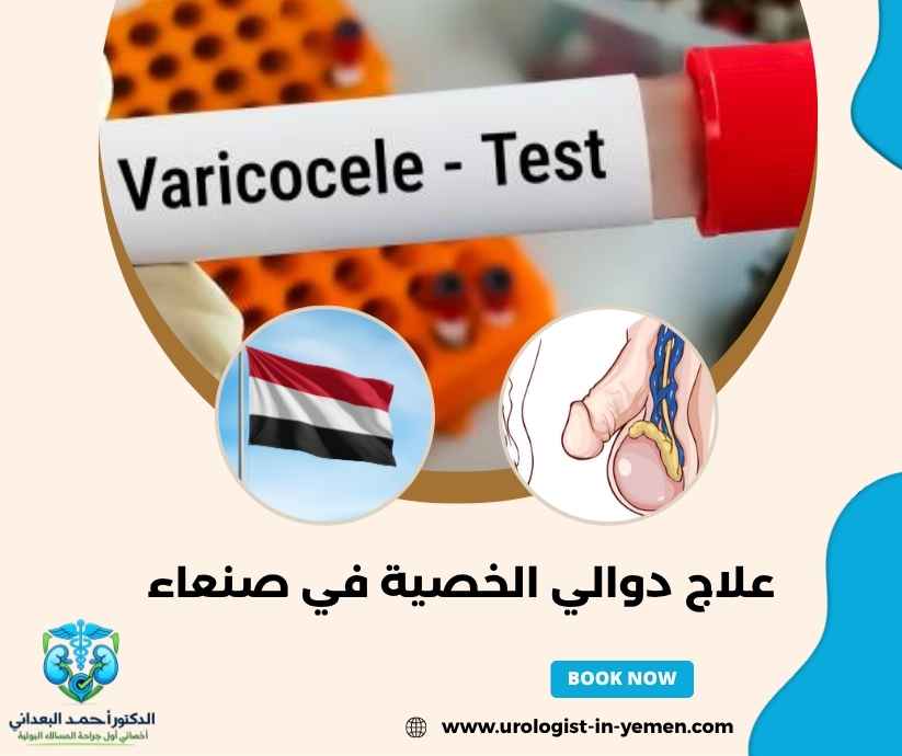 علاج دوالي الخصية في صنعاء علاج دوالي الخصية في صنعاء