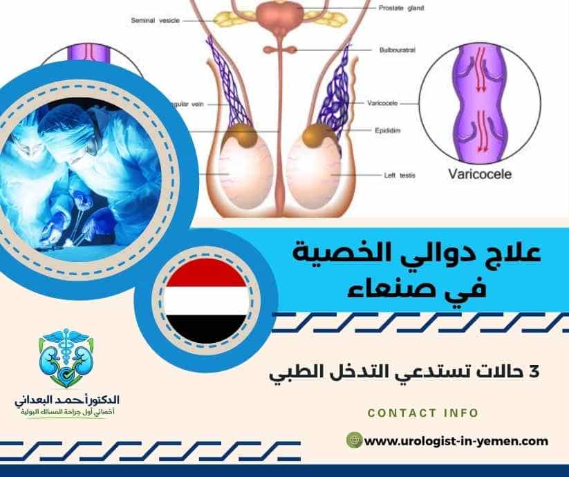 علاج دوالي الخصية في صنعاء
