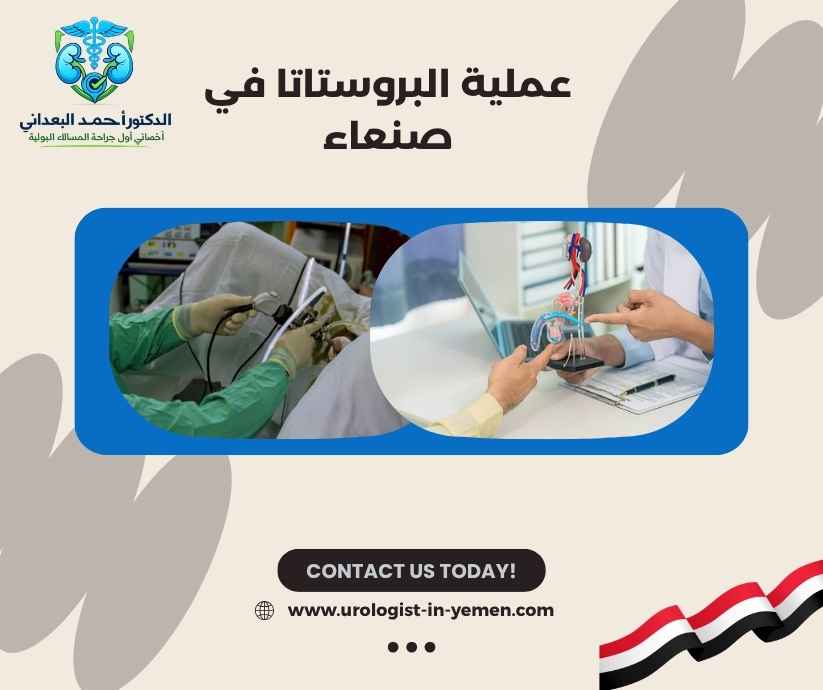 عملية البروستاتا في صنعاء