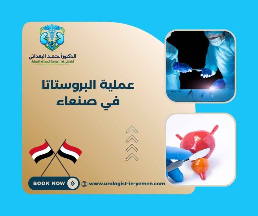 عملية البروستاتا في صنعاء