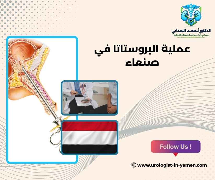 عملية البروستاتا في صنعاء